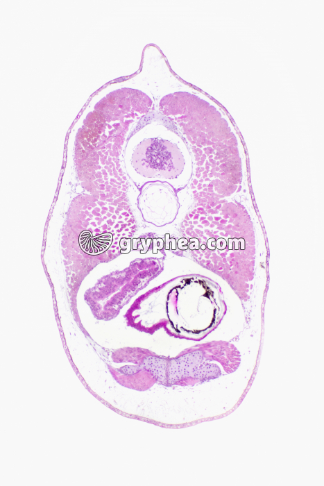 Tétard partie abdominale CT x10 - gryphea.com
